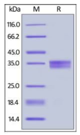 Mouse EpCAM, His Tag on SDS-PAGE under reducing (R) condition. The gel was stained overnight with Coomassie Blue. The purity of the protein is greater than 98%.